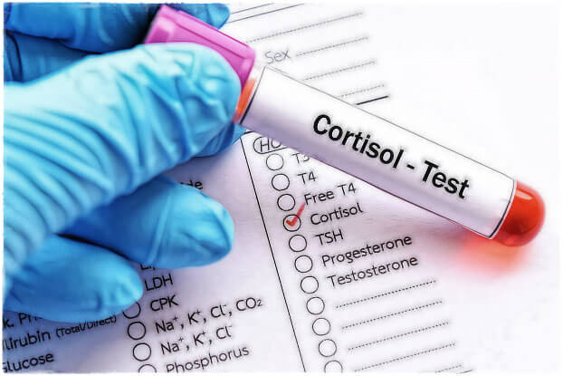 Тест на уровень кортизола в крови